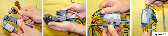 Figura 3.1 Conexión cable de EKG 12 derivaciones
