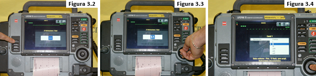 Figuras 3.2 - 3.4: Botón selector EKG 12 derivaciones, selección de edad, señal DATOS RUIDOSOS