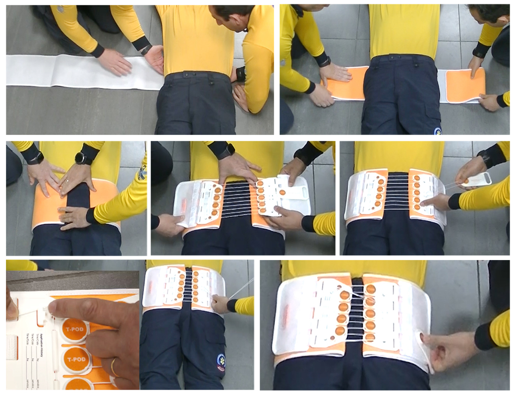 Colocacion Faja Pelvica